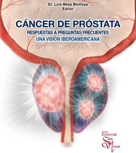 Cáncer-de-próstata-vision-ibero-americana-2023_para-CAU-pdf